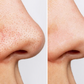 Masque Anti-Points Noirs Skin Drop™